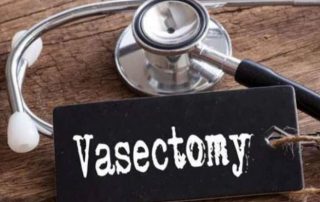 Vasectomy