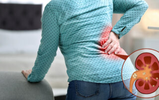 what are the first signs of kidney stones